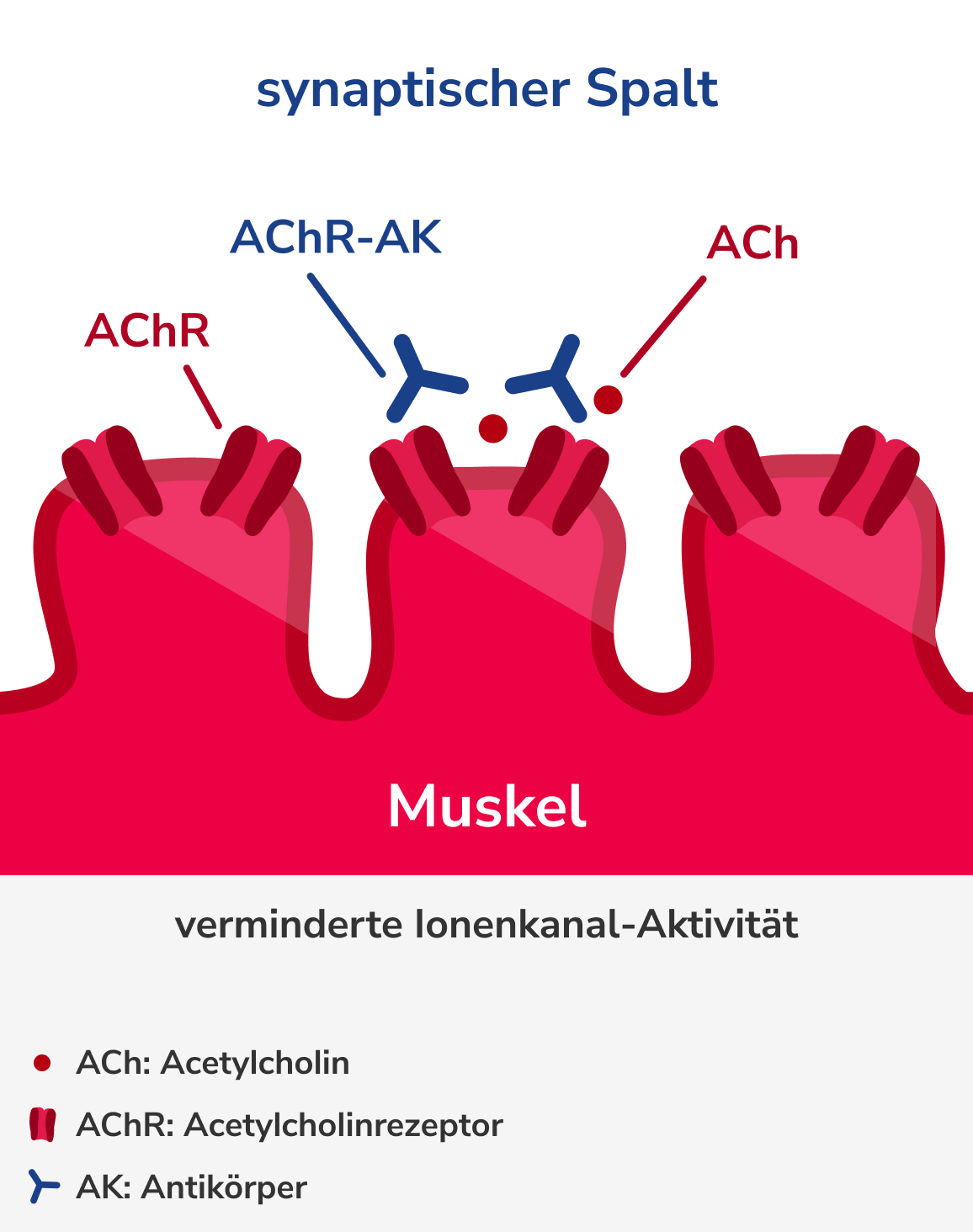 Pathophysiologische Wirkung der AChR-Antikörper, Grafik 1