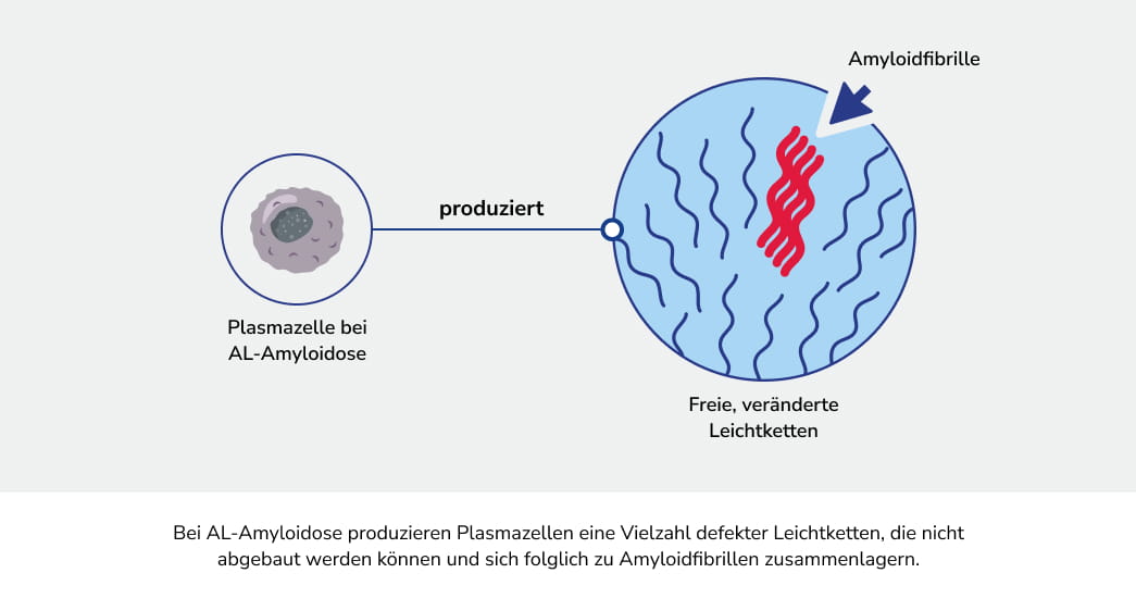 AL-Amyloidose: Diagnose, Symptome & Behandlung | Alexion