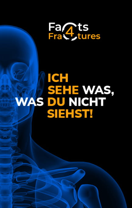 Blaues Skelett mit Logo Facts4Fractures und Schriftzug "Ich sehe was, was du nicht siehst!"